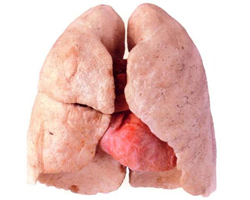 Поверхня легенів - близько 100 квадратних метрів.
Площа поверхні людських легенів приблизно дорівнює площі тенісного корту.
Права легеня людини вміщає в себе більше повітря, ніж ліва.
Доросла людина робить приблизно 23 000 вдихів (і видихів) в день.