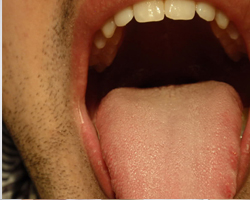 У роті людини близько 40 000 бактерій.
Найсильніший м'яз в людському організмі - язик.
В організмі людини близько 2000 смакових рецепторів.