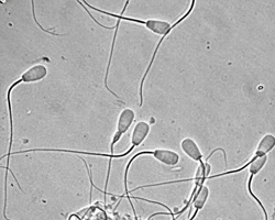 Найдрібніші клітини в організмі чоловіка - клітини сперми.